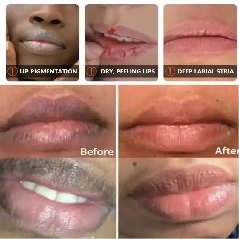 Brightening Lip Balm