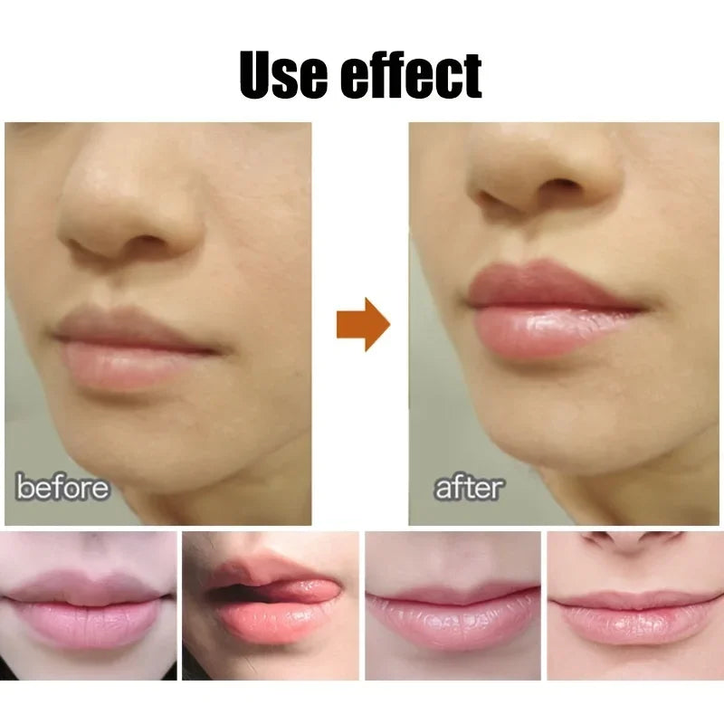 Lip Balm Ball
