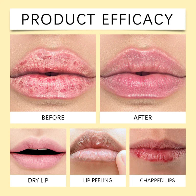 OUHOE Lip Balm