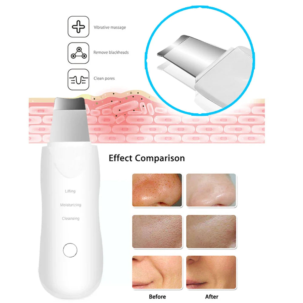 Ultrasonic Skin Scrubber Deep Facial Cleaner
